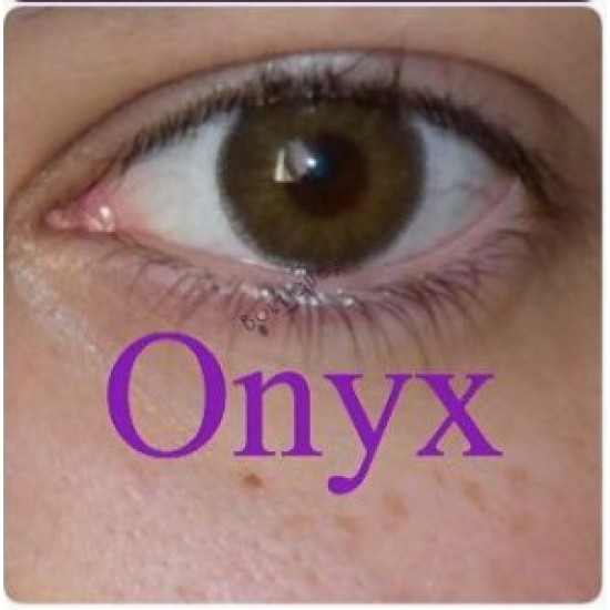 عدسات اوكسيجين mm14.5 ( Onyx )